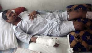 Ahmed Rashad Mushfiq lost both of his legs to a roadside bomb explosion. (Photo courtesy of Pratap Chatterjee.)