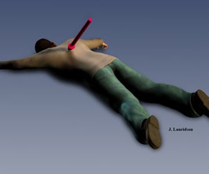 Illustration</p><p>courtesy of Dr. James Lauridson. After examining Matthew McDonald's</p><p>autopsy, Dr. Lauridson, a forensic pathologist, found two possibilities</p><p>for how he was shot, including him lying 'flat on his face.'