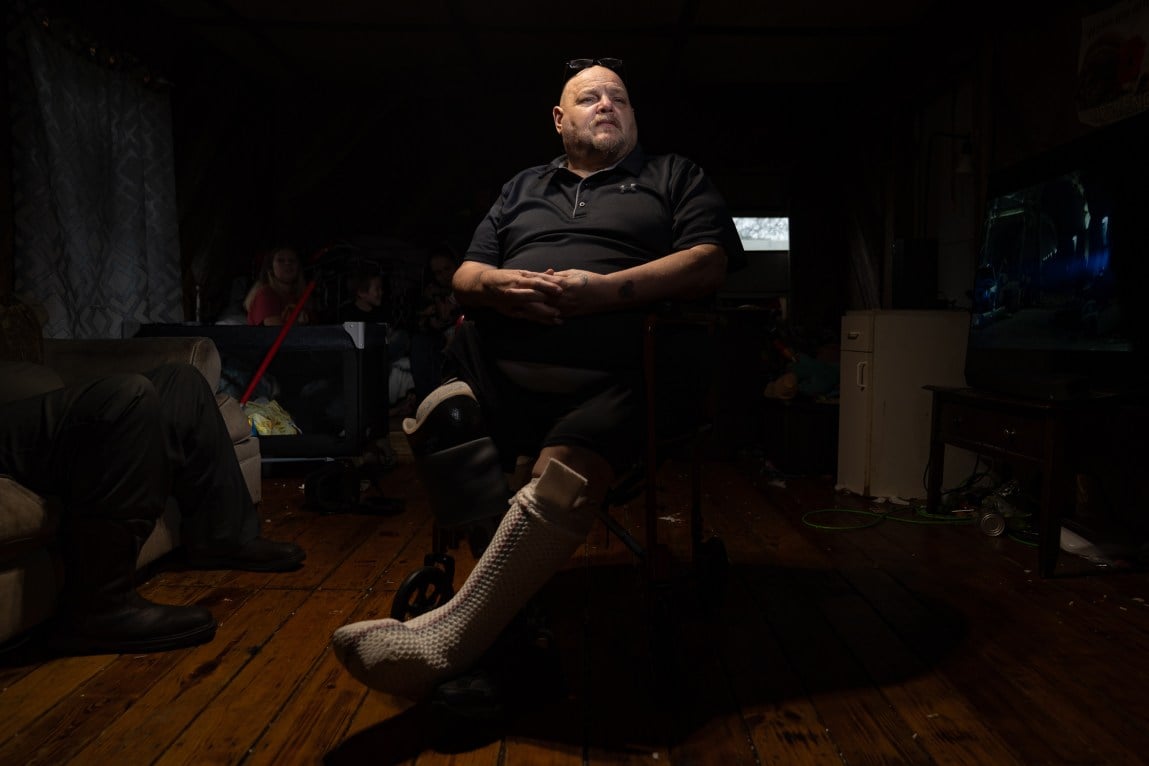 A man sits in a wheelchair. His left leg, which is bandaged, is illuminated by the light.